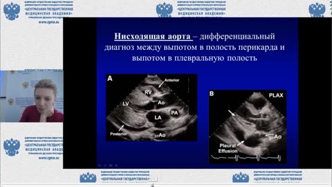 курс "Клиническая эхокардиография" ФГБУ ДПО «Центральная государственная медицинская академия»