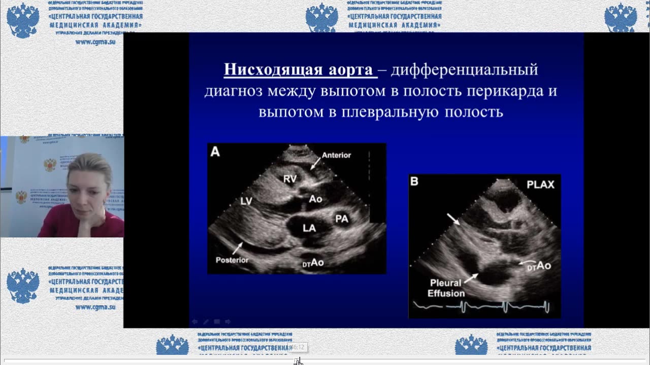 курс "Клиническая эхокардиография" ФГБУ ДПО «Центральная государственная медицинская академия»