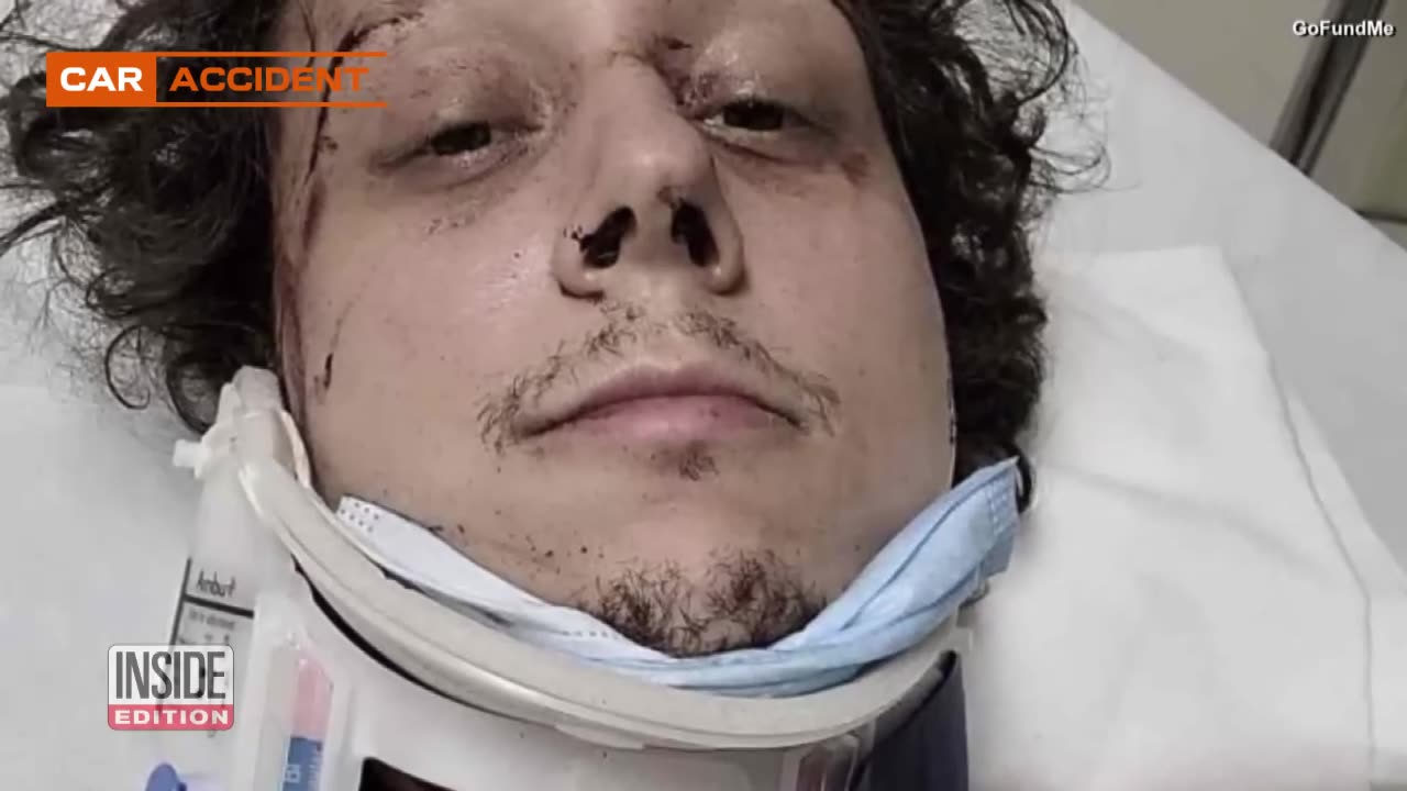 CAR ACCIDENT-2