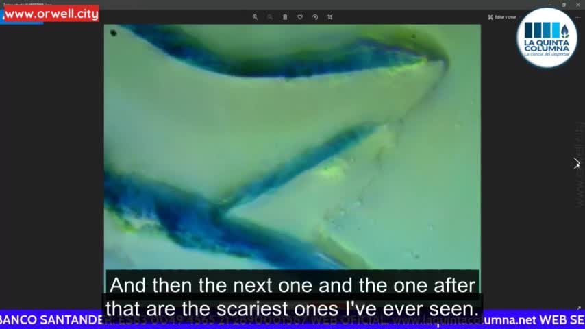 Dr. Sevillano discovers new strange "life forms" in Pfizer vaccine samples
