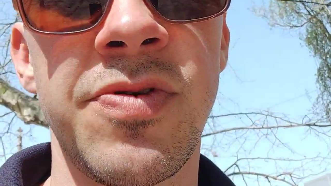 Что делать если хочешь скрыть синяк под глазом