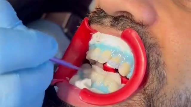 i just want to brush my teeth