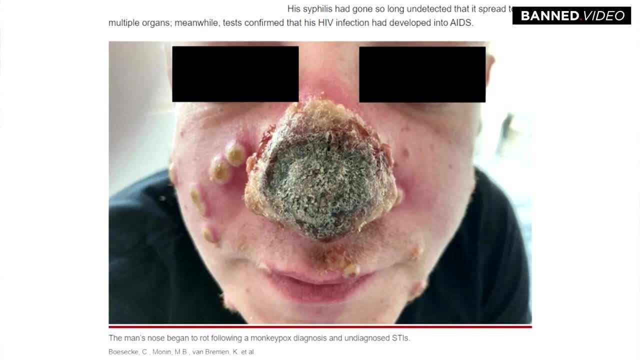 What's happened to his nose?