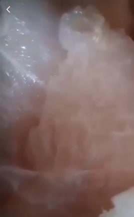 Does Anyone Know What Is Going On Inside This Dead Chicken?