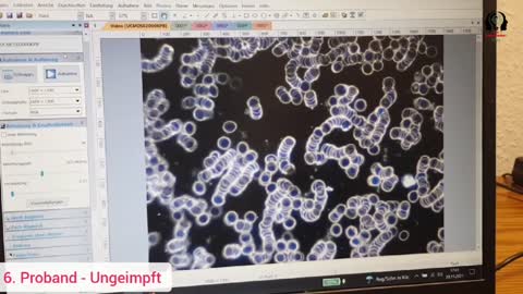 Blutuntersuchung Dunkelfeldmikroskop - 4 Geimpft & 4 Ungeimpft