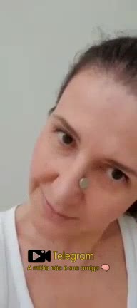 Mulher fica com região nasal magnetizada após fazer o PCR.