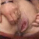 OgMajesticProlapse