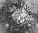 Nischal1