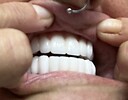 MyBeautifulSmile