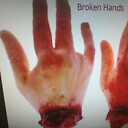 brokenhands1