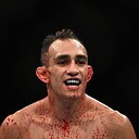 Tony666UFC