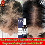 "Transform Your Hair with FEG