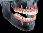 Dental tips and more